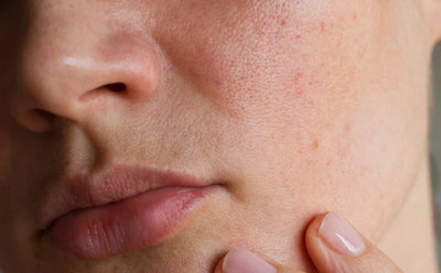 Pores & Sébum