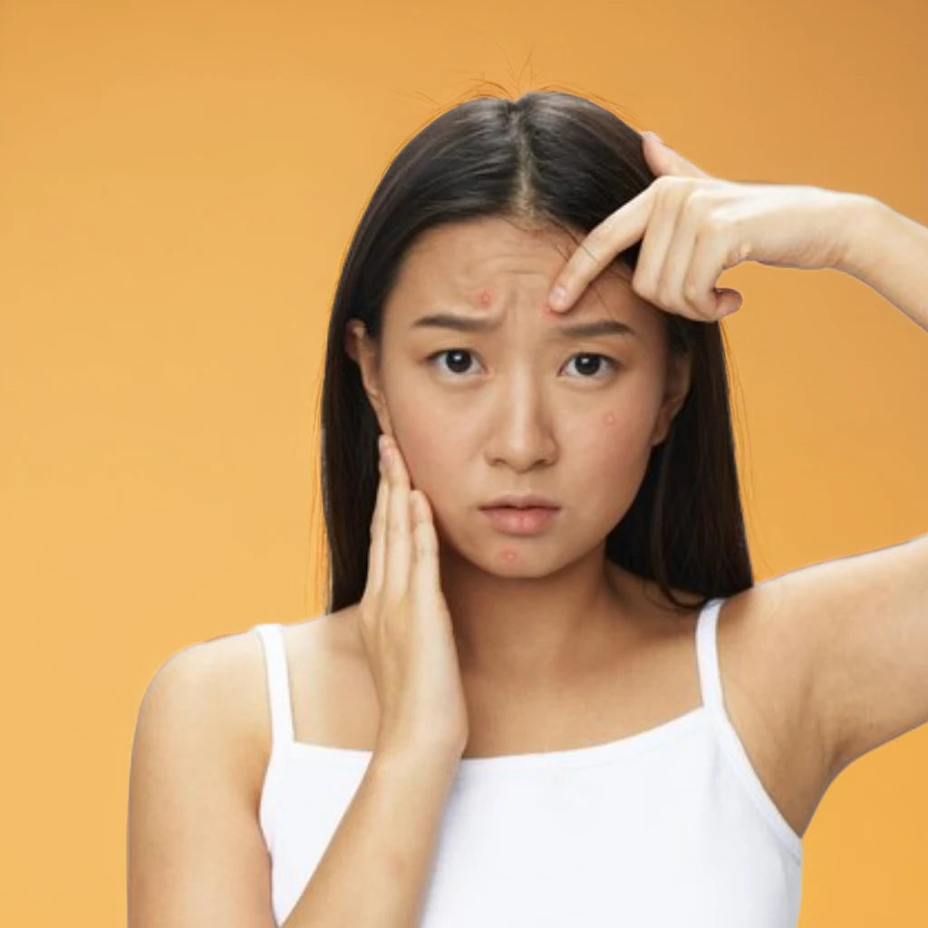 Acné & Éruptions Cutanées